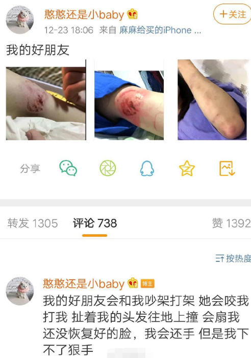 迪努将迎战里昂,队员手臂受伤的简单介绍